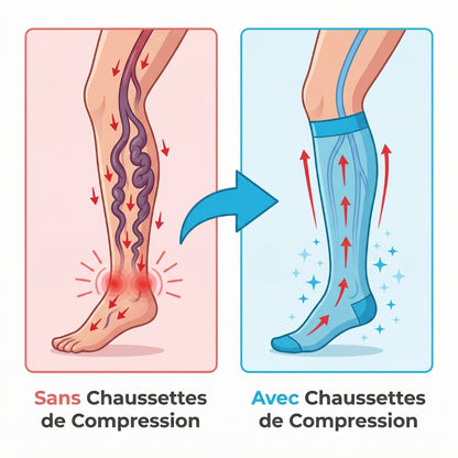 Chaussettes de Circulation Veineuse Pro™